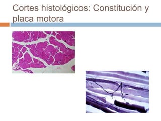 Cortes histológicos: Constitución y
placa motora
 