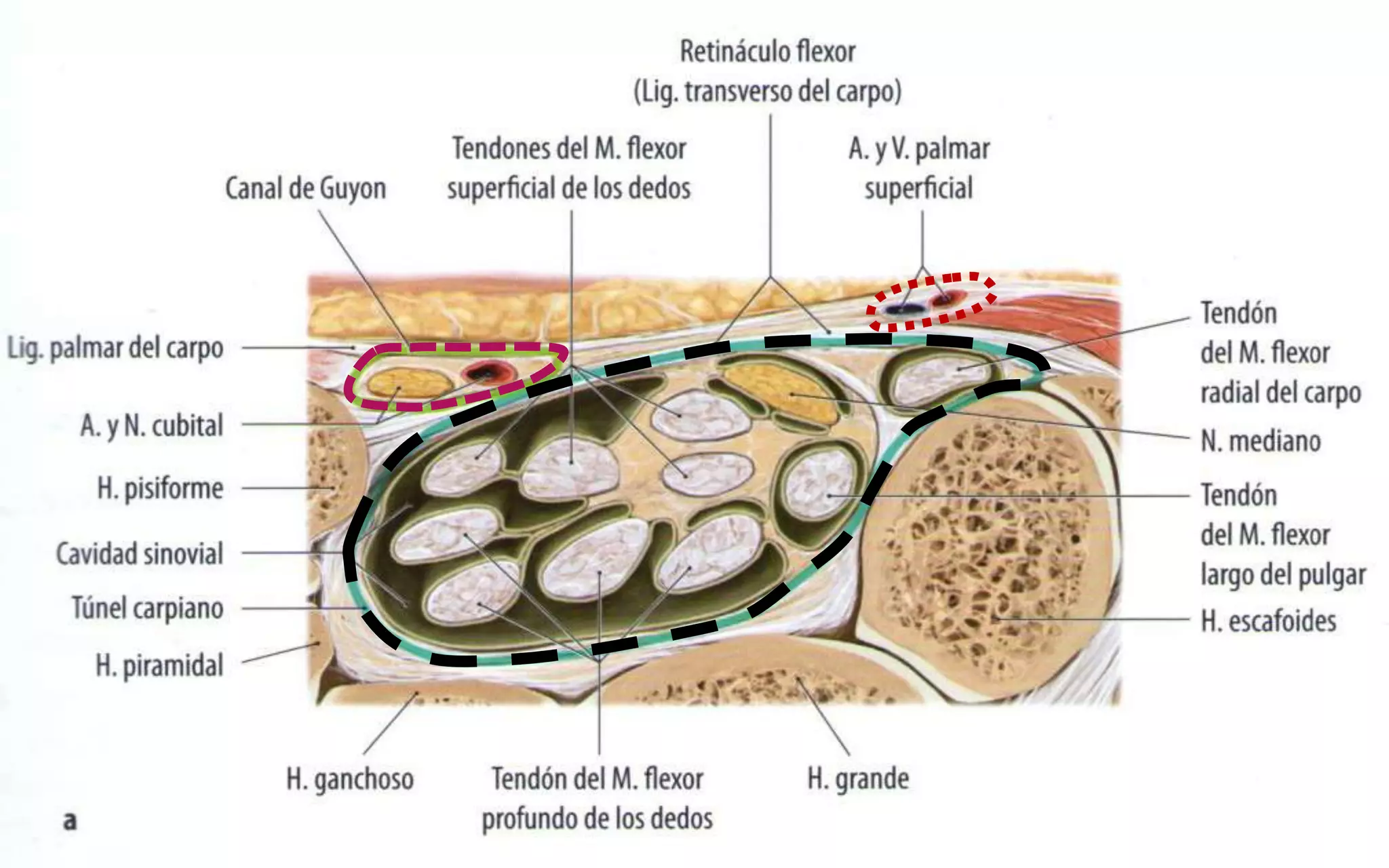 “TUNEL DEL CARPO”
 