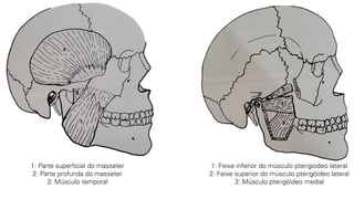 1: Parte superficial do masseter
2: Parte profunda do masseter
3: Músculo temporal
1: Feixe inferior do músculo pterigoideo lateral
2: Feixe superior do músculo pterigóideo lateral
3: Músculo pterigóideo medial
 
