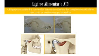Regime Alimentar e ATM
A longo prazo a dieta dos vertebrados determina o formato dos componentes articulares,
bem como os movimentos que ela realiza.
 