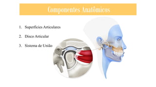 1. Superfícies Articulares
2. Disco Articular
3. Sistema de União
Componentes Anatômicos
 