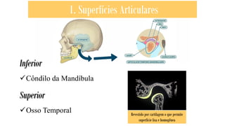 1. Superfícies Articulares
Inferior
✓Côndilo da Mandíbula
Superior
✓Osso Temporal Revestido por cartilagem o que permite
superfície lisa e homogênea
 