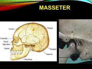 MASSETER
 