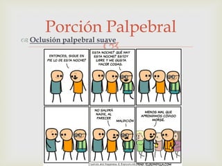 Porción Palpebral
 Oclusión palpebral suave


 