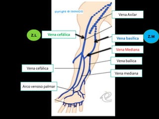 Vena Axilar
Vena cefálica
Vena basílica
Vena Mediana
Vena baílica
Vena mediana
Vena cefálica
Arco venoso palmar
Z.L Z.M
 