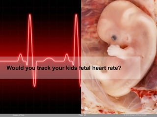 Would you track your kids fetal heart rate?




  Ahead of Time            Page 23            © 2010 Ahead of Time GmbH
 