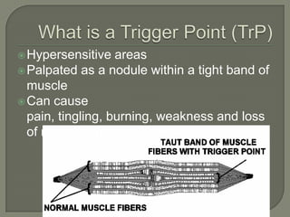 Hypersensitive areas
Palpated as a nodule within a tight band of
muscle
Can cause
pain, tingling, burning, weakness and loss
of range of motion (ROM)
 