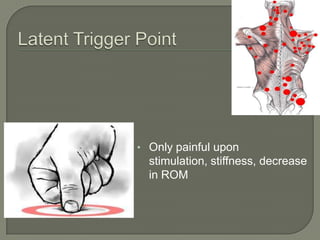 • Only painful upon
stimulation, stiffness, decrease
in ROM
 