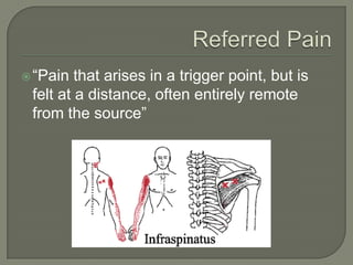 “Pain that arises in a trigger point, but is
felt at a distance, often entirely remote
from the source”
 
