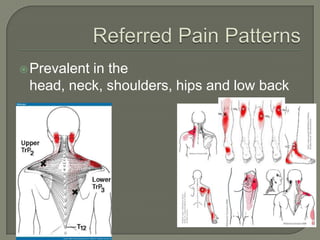 Prevalent in the
head, neck, shoulders, hips and low back
 