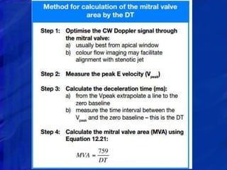 ECHOCARDIOGRAPHIC EVALUATION OF MITRAL VALVE DISEASE | PPTX
