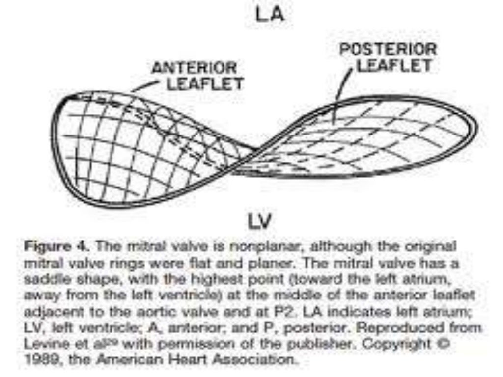ECHOCARDIOGRAPHIC EVALUATION OF MITRAL VALVE DISEASE