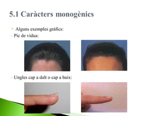 Alguns exemples gràfics:
- Pic de vídua:


- Ungles cap a dalt o cap a baix:

 