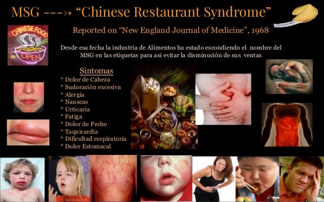 Msg And Chinese Restaurant Syndrome Msg And Chinese Restaurant Syndrome