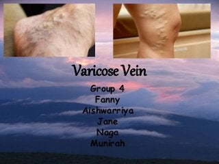 Varicose Vein
Group 4
Fanny
Aishwarriya
Jane
Naga
Munirah
 
