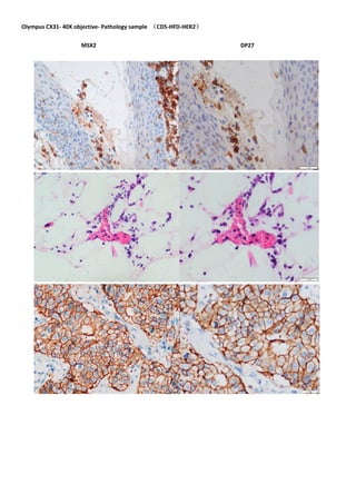 Olympus CX31- 40X objective- Pathology sample （CD5-HFD-HER2）
MSX2 DP27
 