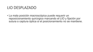 LIO DESPLAZADO
• La mala posición macroscópica puede requerir un
reposicionamiento quirúrgico marcando el LIO y fijación por
sutura o captura óptica si el posicionamiento no se mantiene.
 