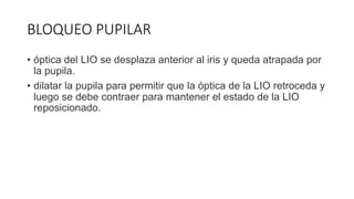 BLOQUEO PUPILAR
• óptica del LIO se desplaza anterior al iris y queda atrapada por
la pupila.
• dilatar la pupila para permitir que la óptica de la LIO retroceda y
luego se debe contraer para mantener el estado de la LIO
reposicionado.
 