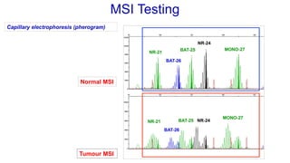 Microsatellite Instability: Detection Methods and Clinical Significance ...