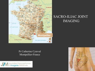 SACRO-ILIAC JOINT
IMAGING

Montpellier

Pr Catherine Cyteval
Montpellier-France

 