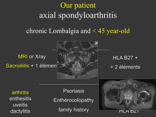 Our patient

axial spondyloarthritis
chronic Lombalgia and < 45 year-old
And
MRI or Xray
Sacroiliitis + 1 élément

arthritis
enthesitis
uveitis
dactylitis

or

HLA B27 +
+ 2 éléments

Psoriasis

AINS good Reponse

Enthérocolopathy

High CRP

family history

HLA B27

 