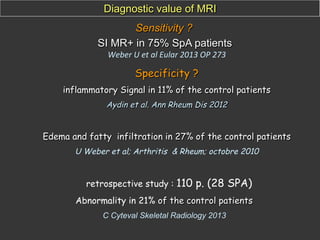 Diagnostic value of MRI
Sensitivity ?
SI MR+ in 75% SpA patients
Weber	
  U	
  et	
  al	
  Eular	
  2013	
  OP	
  273	
  

Specificity ?
inflammatory Signal in 11% of the control patients
Aydin et al. Ann Rheum Dis 2012

Edema and fatty infiltration in 27% of the control patients
U Weber et al; Arthritis & Rheum; octobre 2010

retrospective study : 110

p. (28 SPA)

Abnormality in 21% of the control patients
C Cyteval Skeletal Radiology 2013

 