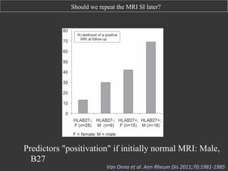 Should we repeat the MRI SI later?

Downloaded from ard.bmj.com on April 15, 2013 - Published by group.bmj.com

Extended report

ccording to the ASAS/OMERACT MRI
tients with early inﬂammatory low back
SpAC

1 Year

2 Years

HLA-B27 positive

+
+
–
+
–
NA
NA
NA
–
–
–
+
+
+
NA

+
NA
+
–
–
+
–
NA
–
+
NA
+
–
NA
NA

8
4
2
0
0
1
0
1
6
0
3
1
0
2
3

s Society; ESpAC, Early Spondyloarthritis Cohort;
7; NA, not available; OMERACT, Outcome
cal Trials.

d either one or two follow-up MRI.
5%), the MRI became positive at 1
HLA-B27-positive patient of these
ed positive at 2 years follow-up, in
nt the MRI became negative again
wo HLA-B27-negative patients the
ars follow-up and in two HLA-B27-

Figure 1 Likelihood of a positive MRI at any time point in patients with
short-standing inﬂammatory back pain assessed at baseline, 1 year and
2 years of follow-up in function of HLA-B27 status and gender. HLA-B27,
human leucocyte antigen B27.

Predictors "positivation" if initially normal MRI: Male,
B27

The likelihood of a positiveVan	
  Onna	
  et	
  al.	
  Ain the case
MRI is negligible (<5%) nn	
  Rheum	
  Dis	
  2011;70:1981-­‐1985	
  	
  

 