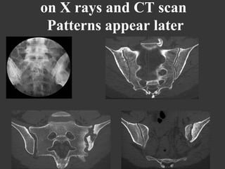 on X rays and CT scan
Patterns appear later

1

 