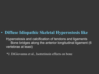 •  Diffuse Idiopathic Skeletal Hyperostosis like
Hyperostosis and calcification of tendons and ligaments
Bone bridges along the anterior longitudinal ligament (6
vertebrae at least)
*J. DiGiovanna et al., Isotretinoin effects on bone

 
