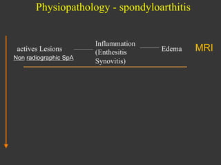 Physiopathology - spondyloarthitis

actives Lesions
Non radiographic SpA

Inflammation
(Enthesitis
Synovitis)

Edema

MRI

 