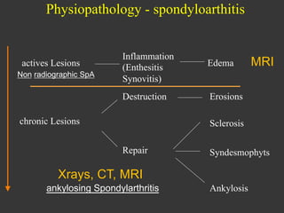 Physiopathology - spondyloarthitis

Non radiographic SpA

Edema

Destruction

actives Lesions

Inflammation
(Enthesitis
Synovitis)

Erosions

chronic Lesions

MRI

Sclerosis
Repair

Syndesmophyts

Xrays, CT, MRI
ankylosing Spondylarthritis

Ankylosis

 