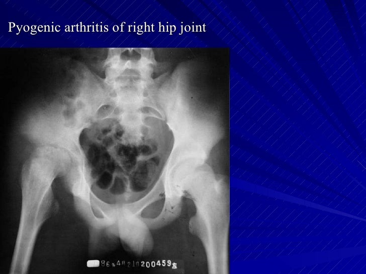 Msk Pratice3 1st Hospital