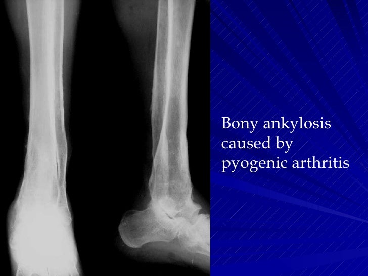 Msk Pratice3 1st Hospital