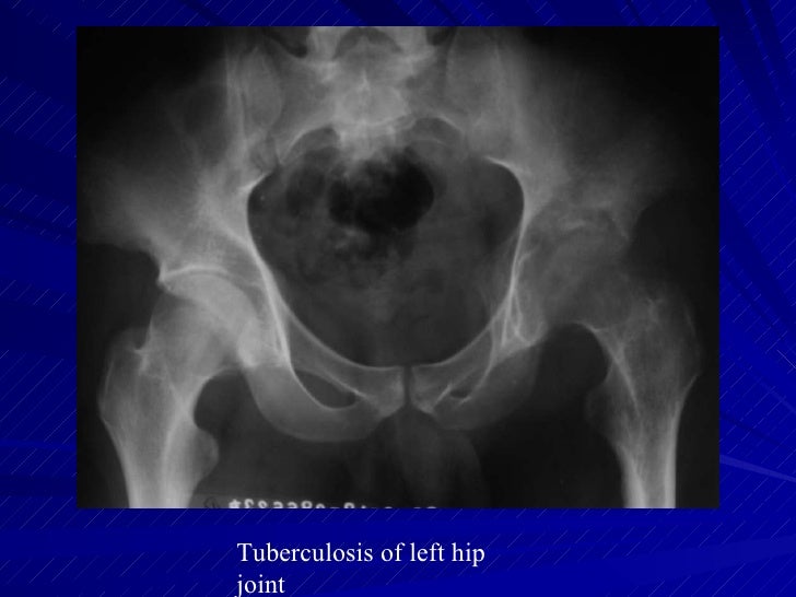 Msk Pratice3 1st Hospital