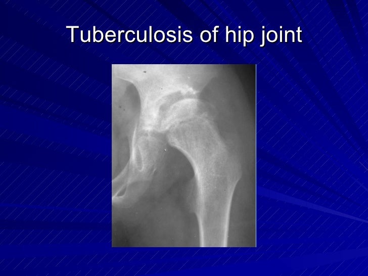 Msk Pratice3 1st Hospital