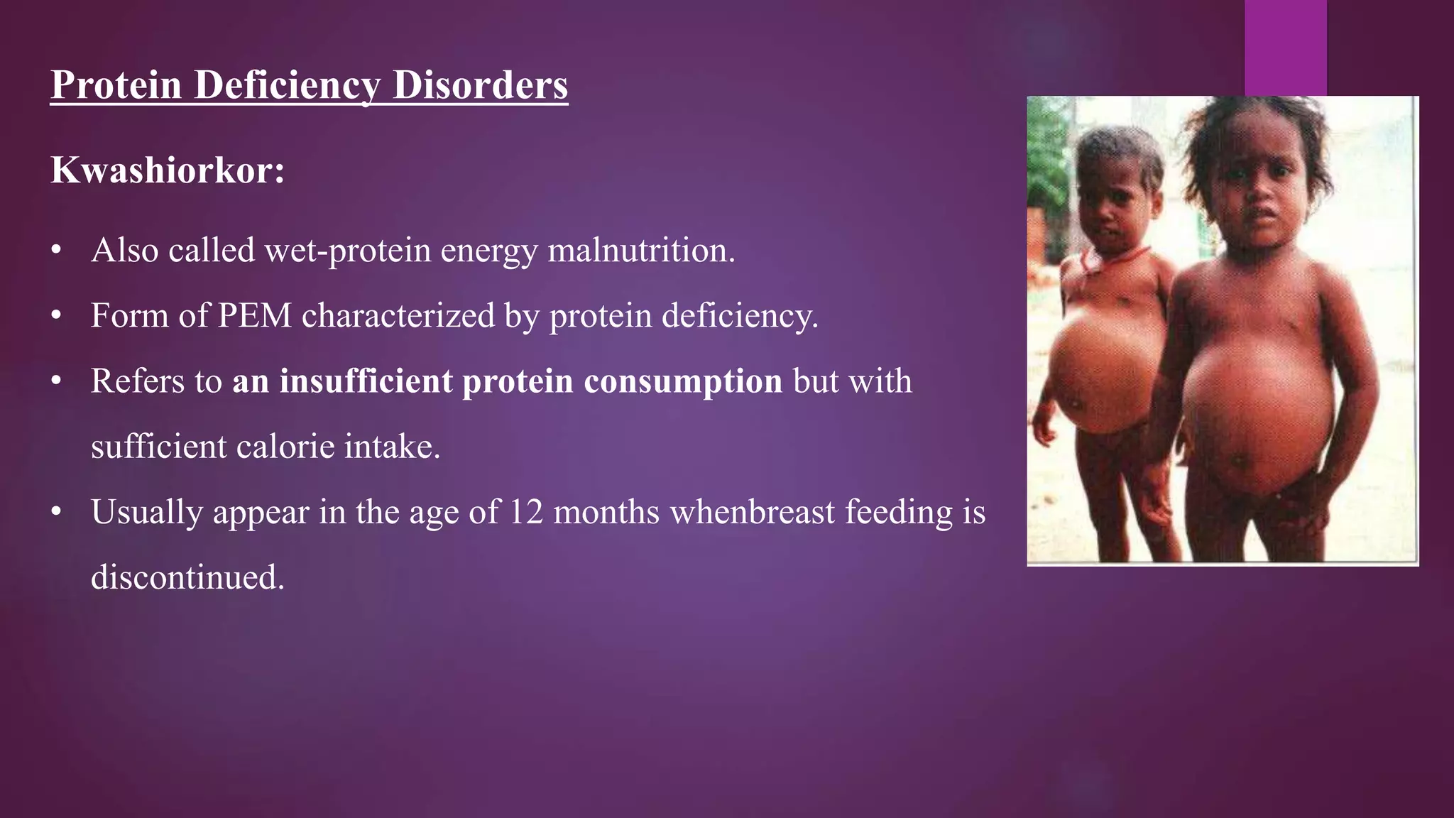 BALANCED DIET & TREATMENT & PREVENTION OF DEFICIENCY DISORDERS | PPTX