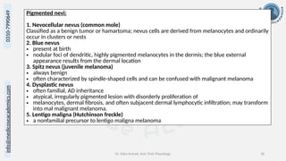 Dr. Sidra Arshad, Asst. Prof. Physiology 18
0310-7990649
info@medicoseacademics.com
Pigmented nevi:
1. Nevocellular nevus (common mole)
Classified as a benign tumor or hamartoma; nevus cells are derived from melanocytes and ordinarily
occur in clusters or nests
2. Blue nevus
• present at birth
• nodular foci of dendritic, highly pigmented melanocytes in the dermis; the blue external
appearance results from the dermal location
3. Spitz nevus (juvenile melanoma)
• always benign
• often characterized by spindle-shaped cells and can be confused with malignant melanoma
4. Dysplastic nevus
• often familial, AD inheritance
• atypical, irregularly pigmented lesion with disorderly proliferation of
• melanocytes, dermal fibrosis, and often subjacent dermal lymphocytic infiltration; may transform
into mal malignant melanoma.
5. Lentigo maligna (Hutchinson freckle)
• a nonfamilial precursor to lentigo maligna melanoma
 