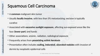 Dr. Sidra Arshad, Asst. Prof. Physiology 20
0310-7990649
info@medicoseacademics.com
Squamous Cell Carcinoma
• A common malignant skin tumor
• Usually locally invasive, with less than 5% metastasizing; excision is typically
curative
• Associated with excessive sunlight exposure, affecting sun-exposed areas like the
face (lower part) and hands
• Other associations: arsenic, radiation, radiological exposure
• Frequently arises from preexisting actinic keratosis
• Presentation often includes scaling, indurated, ulcerated nodules with invasion of
dermis by neoplastic epidermal cells
 