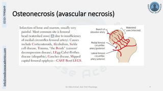 Dr. Sidra Arshad, Asst. Prof. Physiology 9
0310-7990649
info@medicoseacademics.com
Osteonecrosis (avascular necrosis)
 
