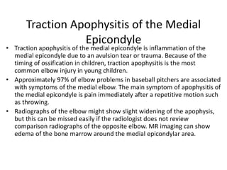 MSK Elbow Injuries .pptx