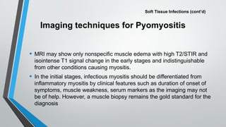 Infectious Pyomyositis Musculoskeletal Infections presentation.pptx
