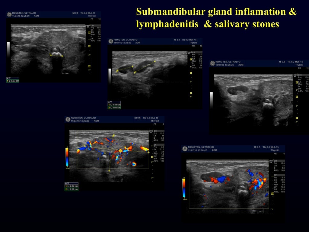 Msk need to know ultrasound lumps & bumps & various joints