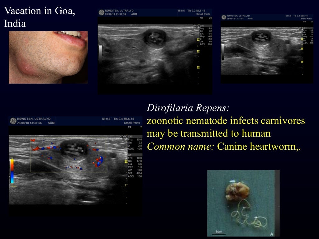 Msk need to know ultrasound lumps & bumps & various joints