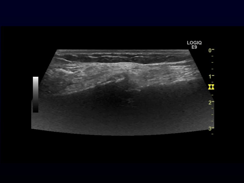 Msk need to know ultrasound lumps & bumps & various joints