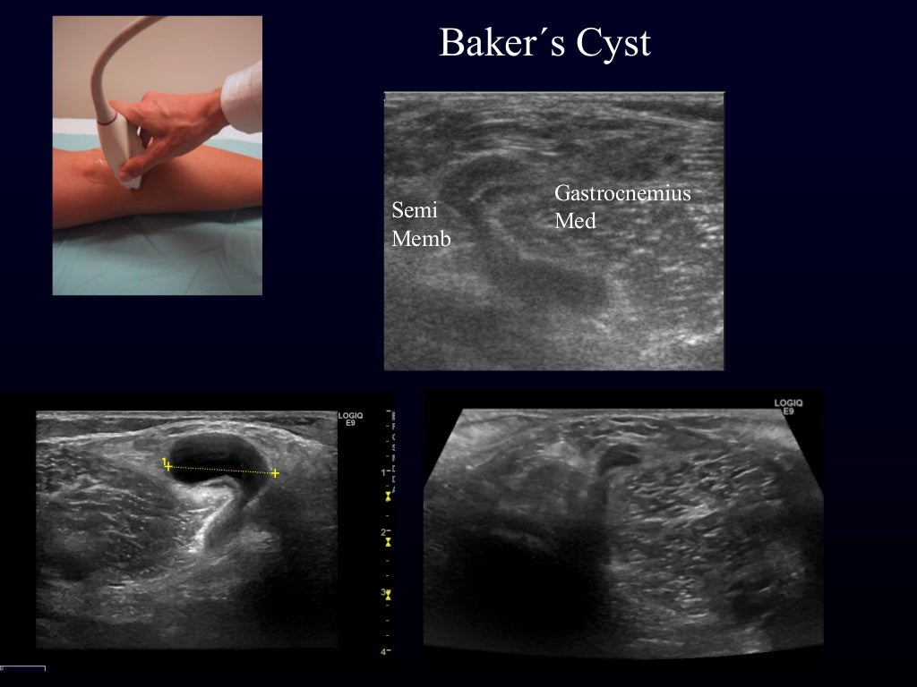 Msk need to know ultrasound lumps & bumps & various joints