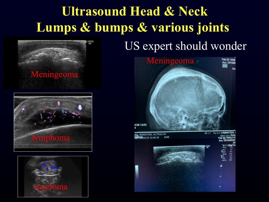 Msk need to know ultrasound lumps & bumps & various joints