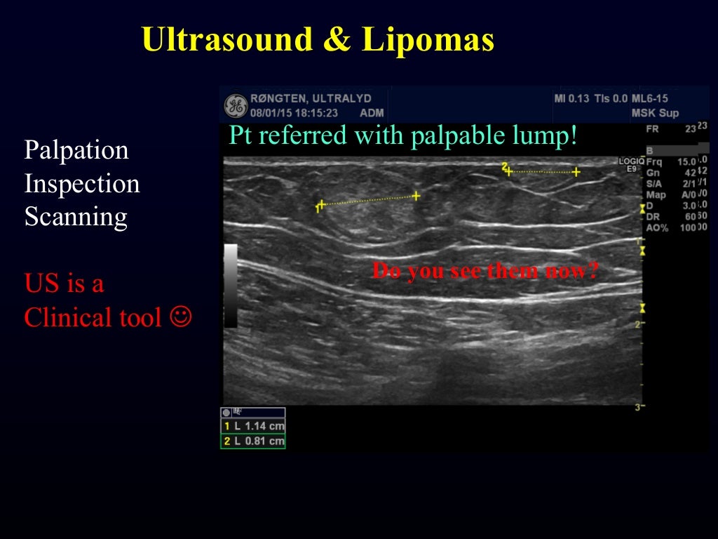 Msk need to know ultrasound lumps & bumps & various joints