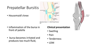 lateral-cross-section-of-knee-choices-common-peroneal-nerve-deep