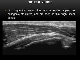 SKELETAL MUSCLE
• On longitudinal views, the muscle septae appear as
echogenic structures, and are seen as thin bright linear
bands.
 