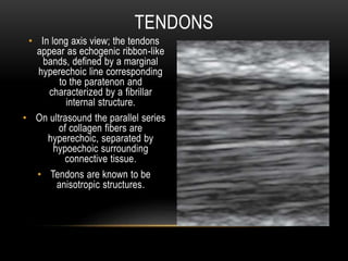 TENDONS
• In long axis view; the tendons
appear as echogenic ribbon-like
bands, defined by a marginal
hyperechoic line corresponding
to the paratenon and
characterized by a fibrillar
internal structure.
• On ultrasound the parallel series
of collagen fibers are
hyperechoic, separated by
hypoechoic surrounding
connective tissue.
• Tendons are known to be
anisotropic structures.
 